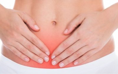 Varizes pélvicas podem ser diagnóstico diferencial para endometriose