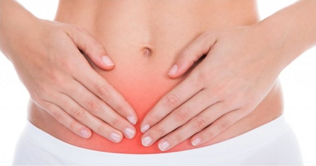 Varizes pélvicas podem ser diagnóstico diferencial para endometriose