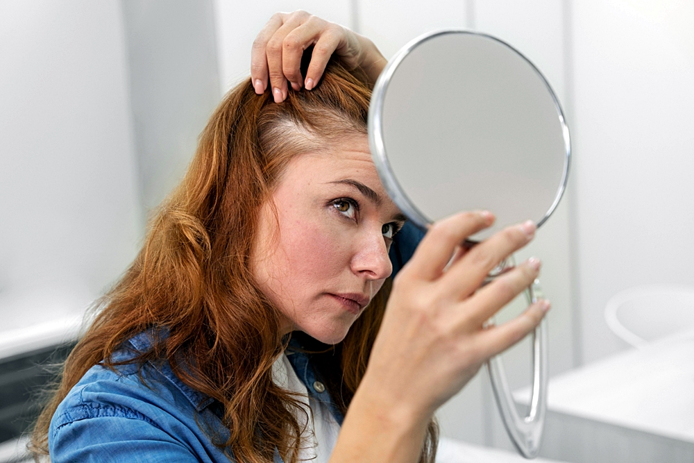 Dermatologistas desvendam segredos sobre a queda de cabelo