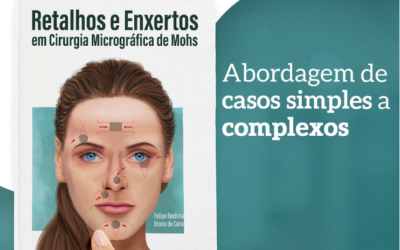 Reconstrução após remoção de câncer de pele na face é tema de publicação inédita no país