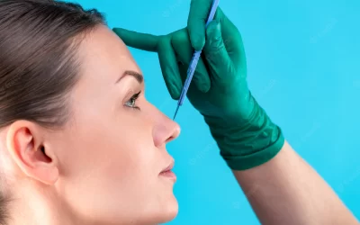 Rinoplastia, a cirurgia que remodela o nariz