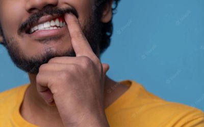 Gengivite: entenda as causas e como uma higiene correta pode ajudar a prevenir a doença